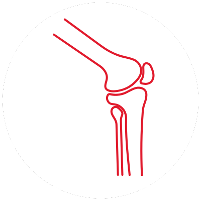 Knee replacement white background